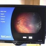 RetCam-II